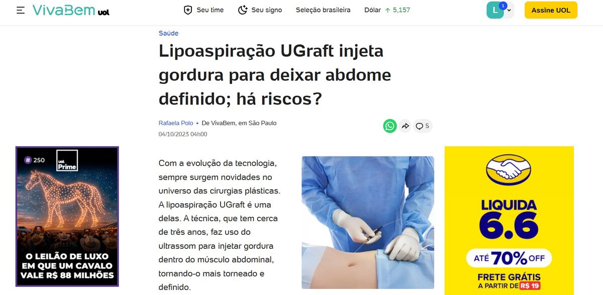 Publicação sobre Dr. Leandro Faustino no UOL VivaBem — lipoaspiração UGraft